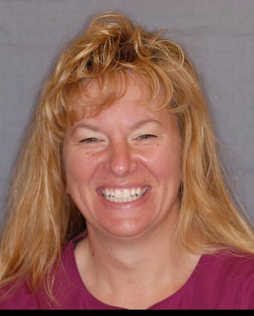 Sunshine Dental PC Your Professional Care Team Watertown NY Dentist